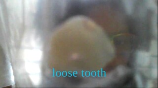 I lost my tooth yay!!!!!!