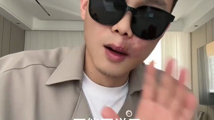 อาการดีขึ้นแล้ว ไม่ต้องนอนโรงพยาบาลอีกต่อไป พี่ชายจะกลับมาหาพวกเราเร็วๆ นี้แล้ว พี่น้องทั้งหลาย!