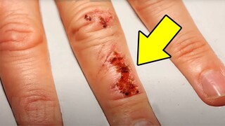 Incredible Time-lapse of Regenerating Skin