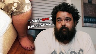 Schizophrenic Foot Fungus Pred Reveals his Darkest Secret...