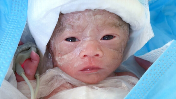 طفل خديج يزن 2 جين، عيونه مزدوجة الجفن وواسعة، لطيف جداً وقويّ جداً.