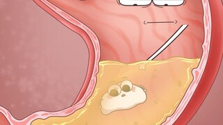 谁小时候没被口香糖骗过？