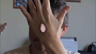 What does it feel like to have a big hole in your hand?