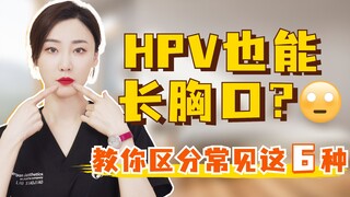 HPV สามารถขึ้นที่หน้าอกได้ด้วยเหรอ? มาเรียนรู้วิธีแยกแยะสิ่งเหล่านี้ที่พบบ่อยกัน!