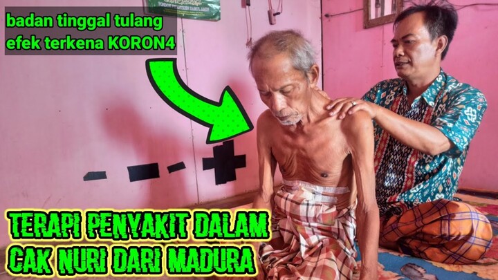 terapi penyakit dalam. tehnik pemijatan warisan leluhur cak nuri dari madura