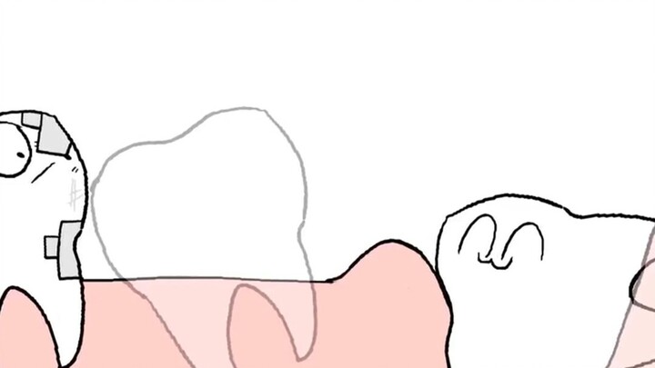 智齿动画 长智齿的感受谁懂