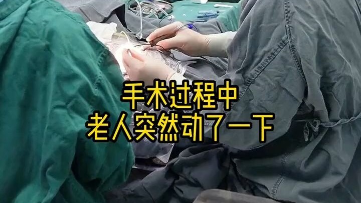 眼科手术中的虚惊一场，竟是老人睡着了，可把医护人员吓坏了。