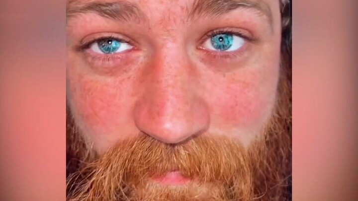 ลูกตาที่งดงามที่สุดในโลก ชายชาวต่างชาติมีดวงตาคู่นี้ดุจพลอยไพลิน ในนั้นมีดวงดาวและมหาสมุทรทอดตัวอยู่