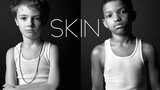 "Skin" Phim ngắn hành động trực tiếp hay nhất Oscar 2019
