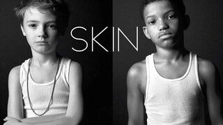 Film Pendek Aksi Langsung Terbaik Oscar "Skin" 2019