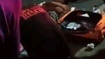 lalake na aksidente, tanggal paa