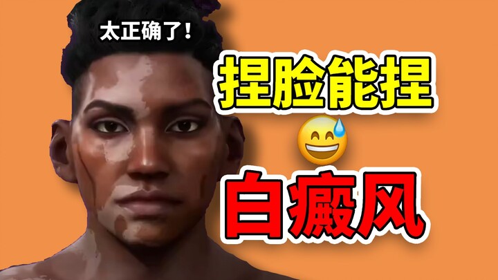 Manipulating vitiligo, manipulating chest transformation scars—IGN China urgently cuts ties! Ubisoft