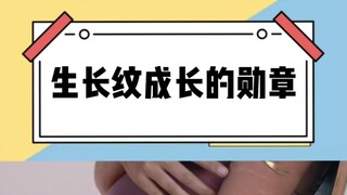 Stretch marks are full of traces of growth. (This content is for entertainment purposes only, contai