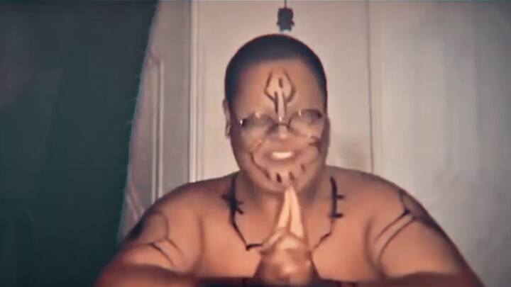 Bermuka dua ~ Cerebral Palsy?