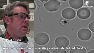 Malaria parasites invading human red blood cell