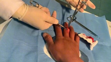 I was killed by watermelon