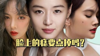 ไฝบนใบหน้าควรจี้ออกไหม