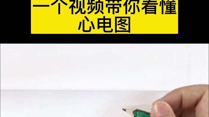 Video ini Bantu Kamu Pahami “Penjelasan Mendalam tentang EKG” Secara Lengkap