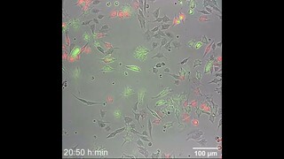 Time-lapse imaging of cell-cell interactions detected using SyNPL