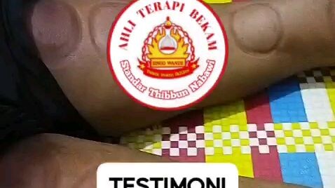 TESTIMONI BEKAM SUNNAH