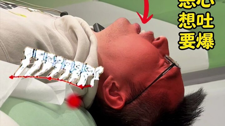 Jangan coba! Bisa cacat! Dr. Peng, ahli tulang belakang yang ditunjuk khusus untuk Olimpiade, member