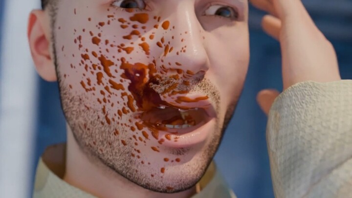 The teeth stopped the bullet and saved him.