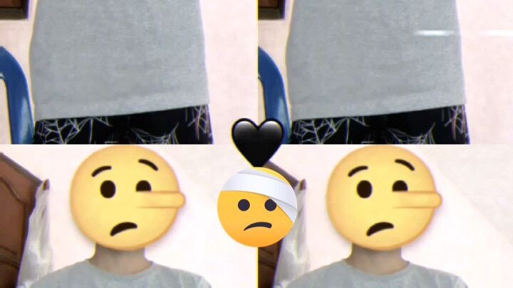 😖