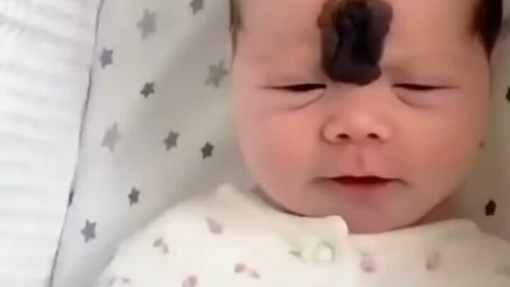 The little girl’s birthmark between her brows is fading—her parents must love her so much!