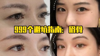 999 hướng dẫn tránh bẫy: Gò má
