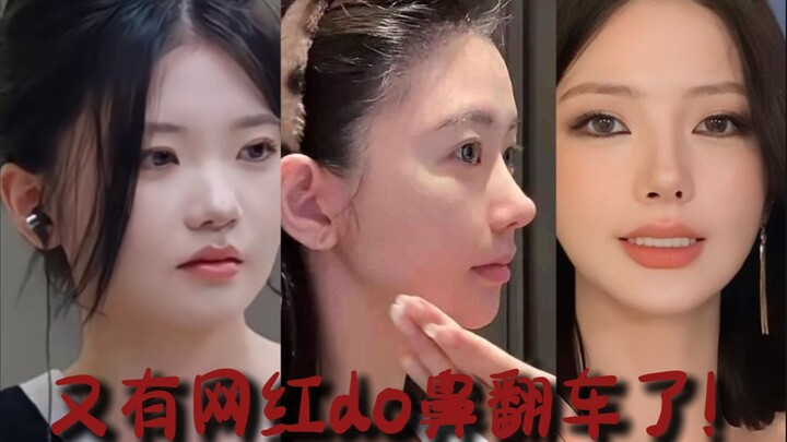 又有网红do鼻翻车了！