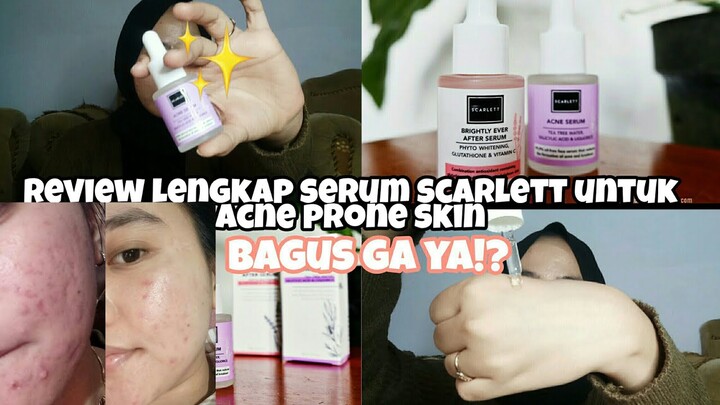 2 MINGGU PEMAKAIAN SERUM SCARLETT DAN HASILNYA ... KAGET BANGET 😭😭