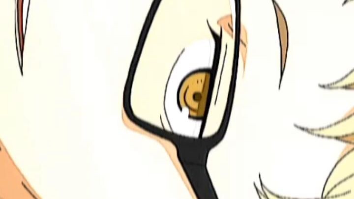 Kenma tetap di ginjal 🗿🤙