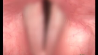 Vocal Fold Vibrations Under Laryngoscopy: I Finally Understand That This Is the Anatomical Basis Beh