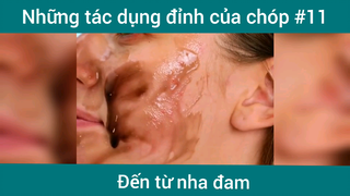Những tác dụng đỉnh của nha đam p11