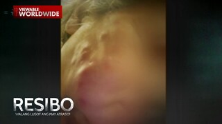 Isang ginang, nasira ang mukha dahil sa mga treatment ng 'di lisensyadong dermatologist?! | Resibo