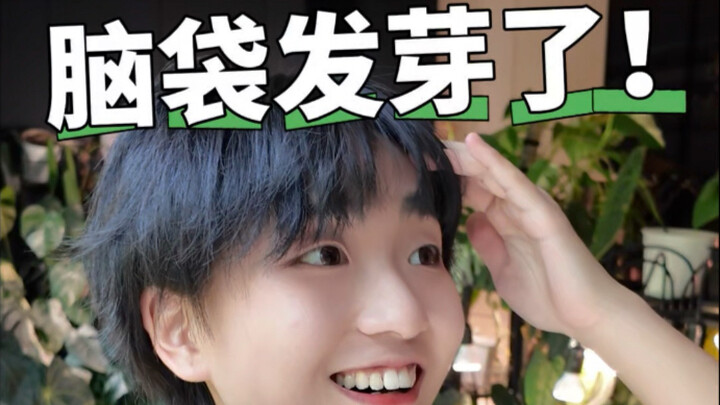 Vlog transplantasi rambut! Gak perlu khawatir lagi angin menerbangkan kulit kepala saya…