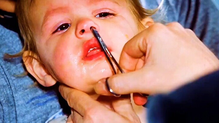 A shocking capture is taking place in the little boy's nostrils
