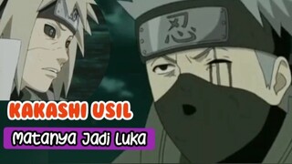 Kakashi Usil Matanya Jadi Luka.by. Naruto