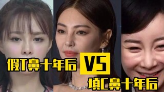假T鼻vs填C鼻十年后会怎样
