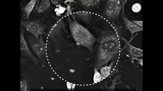 Webinar Cell Death - Cell multinucleation following exposure to 1 µM Taxol