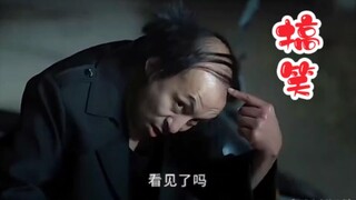มันไม่ได้เจ็บมากหรอก แต่มันน่าเจ็บใจสุดๆ! ขำไม่หยุดเลย...