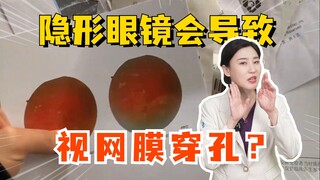 Apakah lensa kontak dapat menyebabkan perforasi retina?