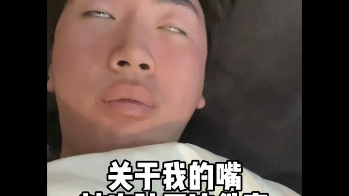 عن تورّم فمي بسبب البرد