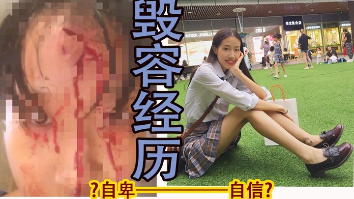 Disfiguring Experience | What Did I Go Through From Low Self-Esteem to Confidence? | How to Step Out