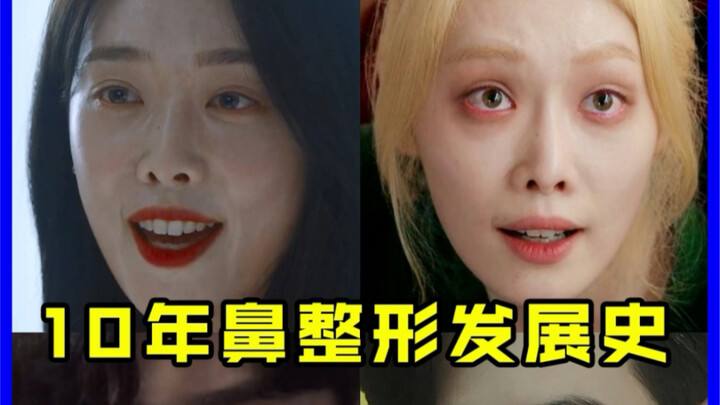 【Toàn thương】Lịch sử 10 năm của phẫu thuật mũi