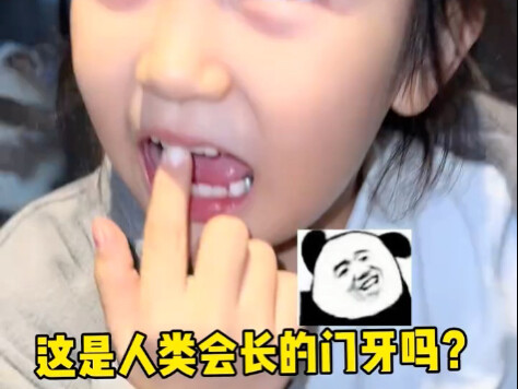 Đây có phải là răng cửa của con người không?