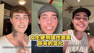 女生使用雄性激素五个月 声音和样貌的变化