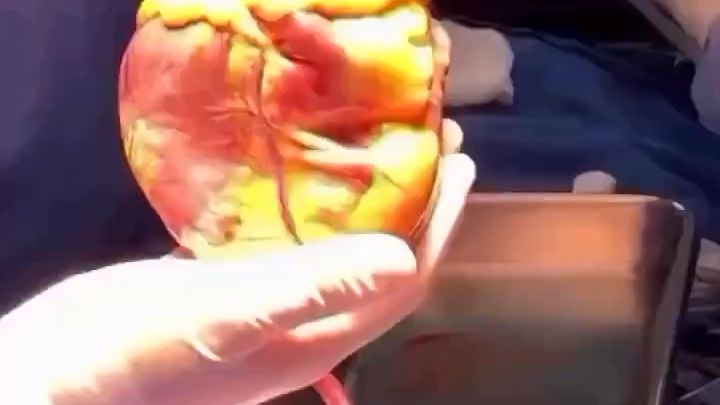 Nhịp đập cuối cùng