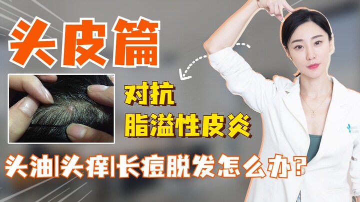 头皮篇：对抗脂溢性皮炎，头油/头痒/还长痘脱发怎么办？