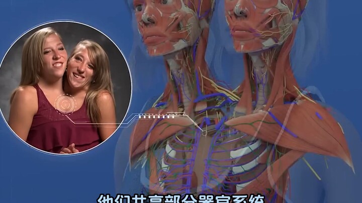 A Full Breakdown of the Body Structure in “Abby & Brittany,” the Conjoined Twins